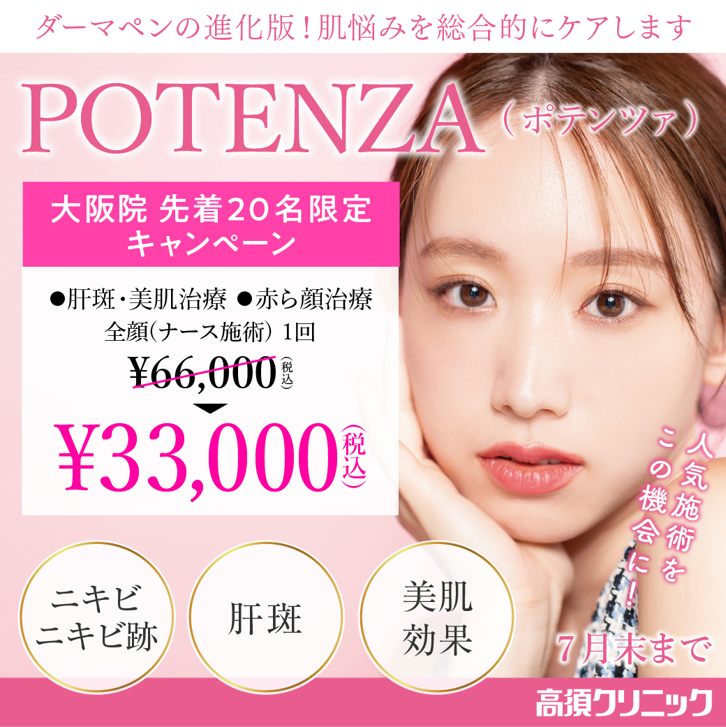 ポテンツァ キャンペーン