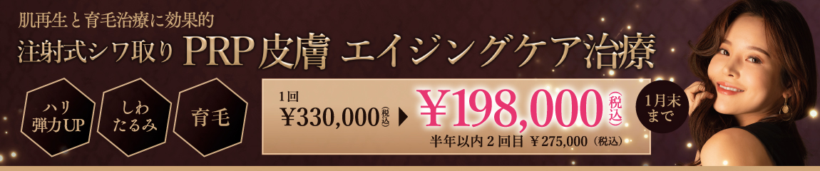 キャンペーン