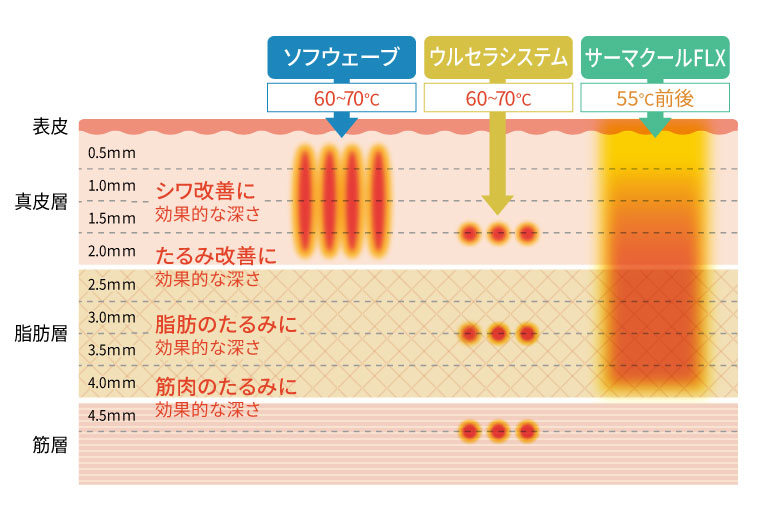 照射エリア、効果のあるお肌の層の比較表