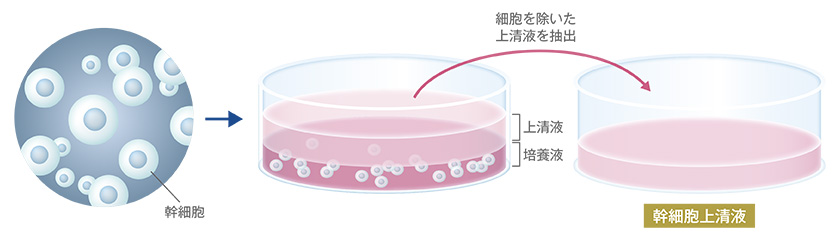 幹細胞培養上清液の作成過程イメージ