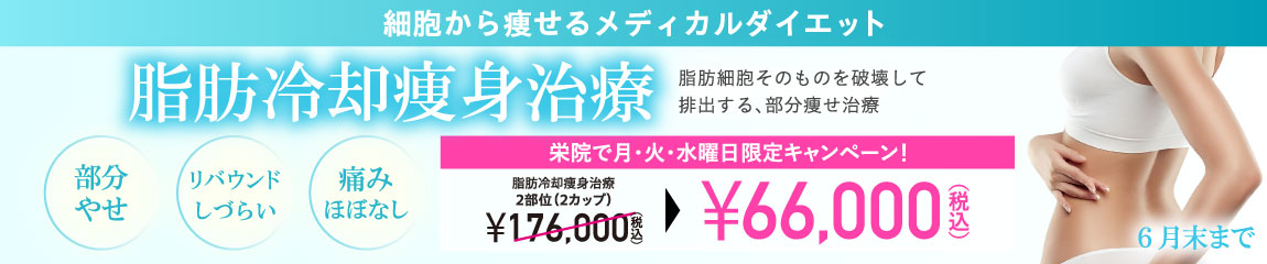 脂肪冷却痩身治療 ディファイン キャンペーン/栄院 月・火・水曜日限定/6月末まで