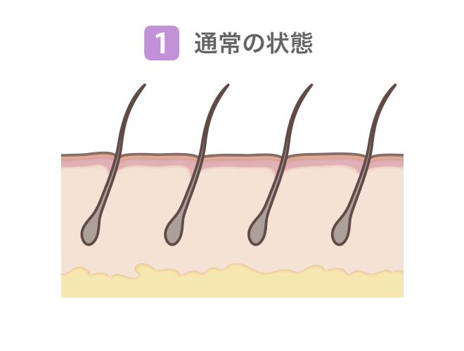 (1)通常の状態