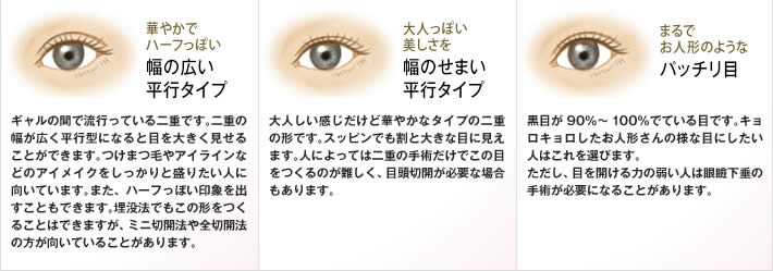 幅広い平行タイプ：ギャルの間で流行っている二重です。二重の幅が広く平行型になると目を大きく見せることができます。つけまつ毛やアイラインなどのアイメイクをしっかりと盛りたい人に向いています。また、ハーフっぽい印象を出すこともできます。埋没法でもこの形をつくることはできますが、ミニ切開法や全切開法の方が向いていることがあります。／幅のせまい平行タイプ：大人しい感じだけど華やかなタイプの二重の形です。スッピンでも割と大きな目に見えます。人によっては二重の手術だけでこの目をつくるのが難しく、目頭切開が必要な場合もあります。／パッチリ目：黒目が約90％～100％でている目です。キョロキョロしたお人形さんの様な目にしたい人はこれを選びます。ただし、目を開ける力の弱い人は眼瞼下垂の手術が必要になることがあります。