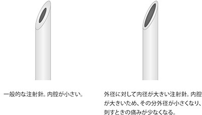 一般的な注射針。内腔が小さい。外径に対して内径が大きい注射針。内腔が大きいため、その分外径が小さくなり、刺すときの痛みが少なくなる。