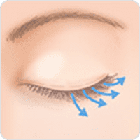 まつ毛育毛 グラッシュビスタ®