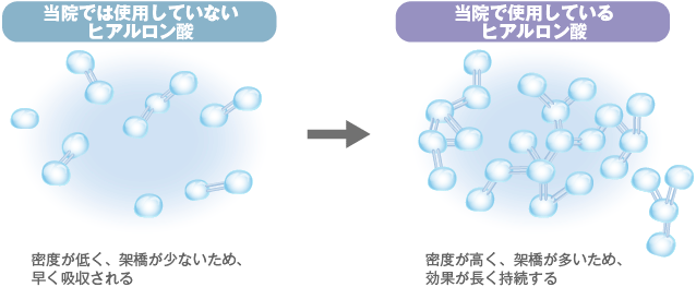 一般的なヒアルロン酸:密度が低く、架橋が少ないため、早く吸収される→当院採用のヒアルロン酸:密度が高く、架橋が多いため、効果が長く持続する