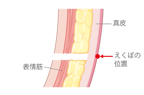 えくぼ形成 あご 輪郭 小顔 美容整形の高須クリニック