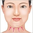 二重あご改善