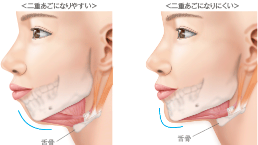 二重あごを治すには 脂肪吸引 小顔専用脂肪溶解注射メソシェイプフェイス 二重あごの改善法について Dr 高須幹弥の美容整形講座 美容整形の高須クリニック