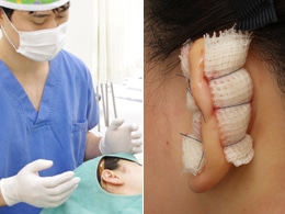 手術風景 軟膏ガーゼで圧迫