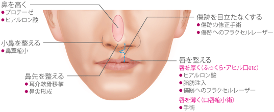 鼻を高く　小鼻を整える　鼻先を整える　傷跡を目立たなくする　唇を整える（唇を厚く（ふっくら・アヒル口etc）／唇を薄く（口唇縮小術））