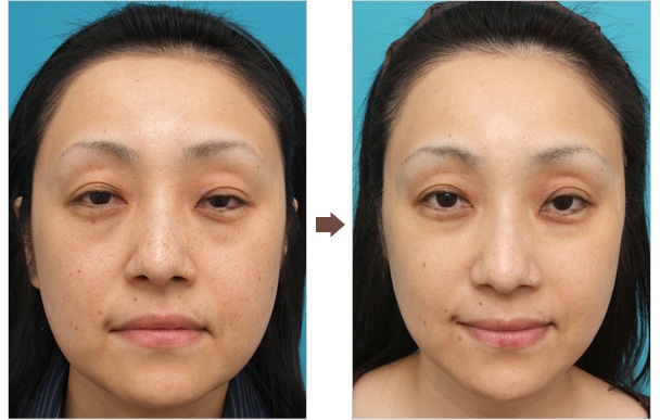 肌（美容皮膚科）の施術について：Dr.高須幹弥の美容整形講座：美容 