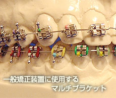 一般矯正装置に使用するマルチブラケット