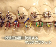 一般矯正装置に使用するマルチブラケット