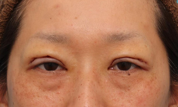  6. トーマカフェ