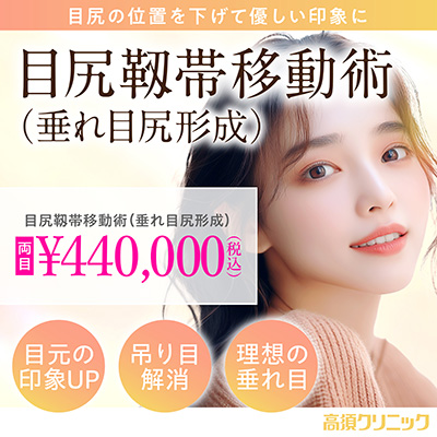 目尻の位置を下げて優しい印象に/目尻靭帯移動術（垂れ目尻形成）