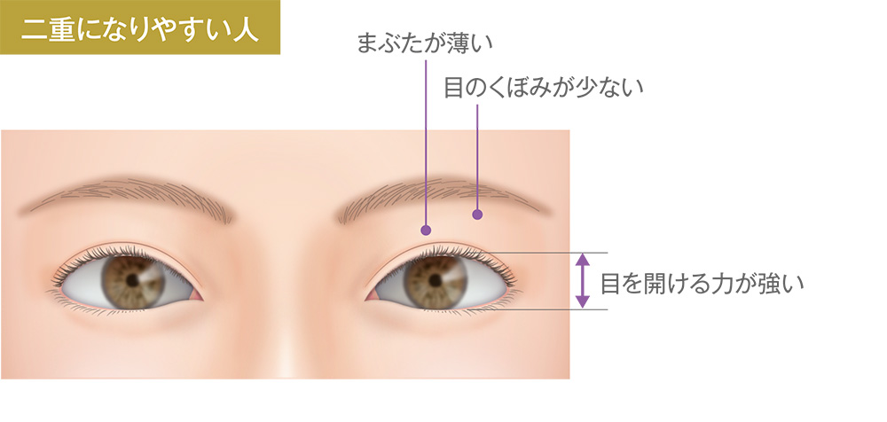 二重になりやすい人/まぶたが薄い、目のくぼみが少ない、目を開ける力が強い