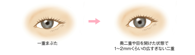 一重まぶた　奥二重や目を開けた状態で1～2mmくらいの広すぎない二重