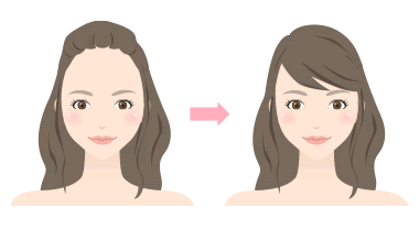 女性で額 おでこ が広い人を狭くする治療はあるのか 植毛手術などは有効か 男性の場合は Dr 高須幹弥の美容整形講座 美容整形の高須クリニック
