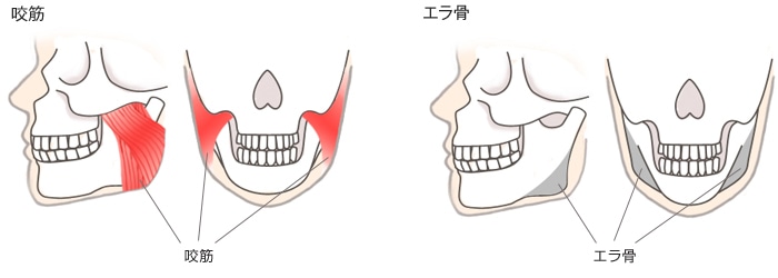 咬筋とエラ骨の部位 咬筋 エラ骨