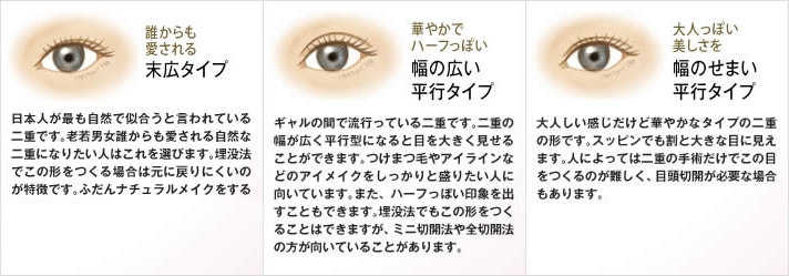 末広型二重と平行型二重はどちらが目が大きく見えるのか 自然なのはどちら 蒙古襞との関係について Dr 高須幹弥の美容整形講座 美容整形の高須クリニック