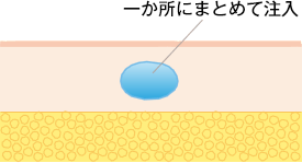 一ヶ所ににまとめて注入