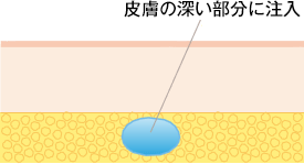 皮膚の深い部分に注入