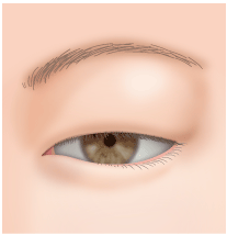 天然の一重まぶたと二重まぶたと奥二重の違い 埋没法や切開法で二重まぶたになる仕組みについて Dr 高須幹弥の美容整形講座 美容整形の高須クリニック