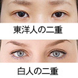 目から眉までの距離を近づけるにはどうしたらいいのか Dr 高須幹弥の美容整形講座 美容整形の高須クリニック