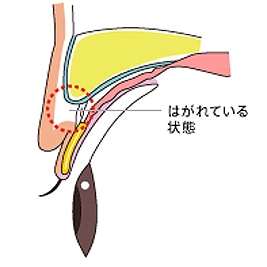 美容整形講座