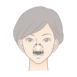 鼻をほじると 鼻の穴が広がって大きくなるのか 小鼻縮小手術後の人や手術していない人に関して Dr 高須幹弥の美容整形講座 美容整形の高須クリニック