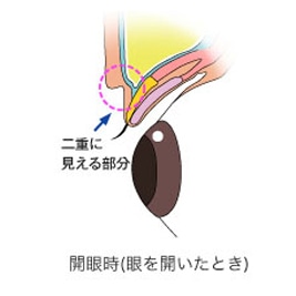 美容整形講座