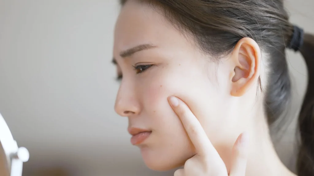 美容皮膚科医が教える自力でそばかすを薄くする方法や予防のポイントは？