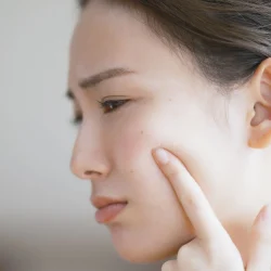 美容皮膚科医が教える自力でそばかすを薄くする方法や予防のポイントは？