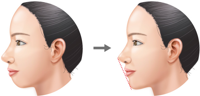 お望みは 可愛い Or 綺麗 あなたの願いを叶える方法 美容整形の高須クリニック