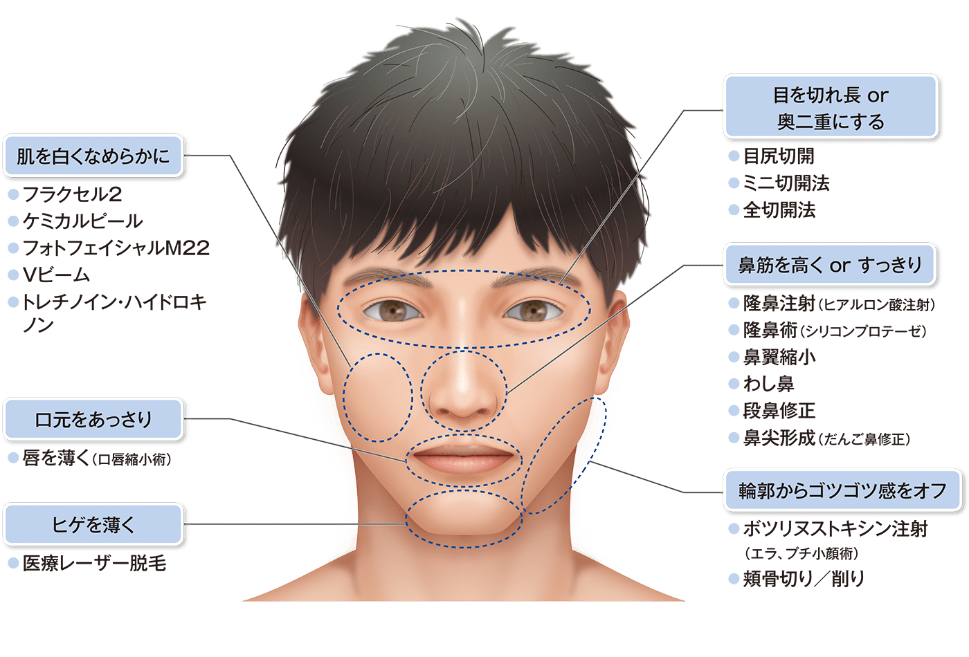 肌を白くなめらかに 口元をあっさり ヒゲを薄く 目を切れ長or奥二重にする 鼻筋を高くorすっきり 輪郭からゴツゴツ感をオフ