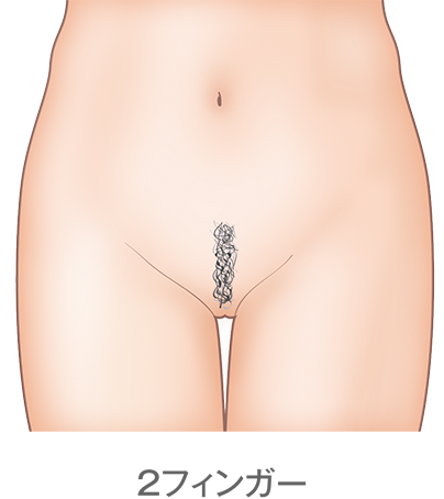2フィンガー